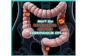 Kolorektal (Kalın Bağırsak) Kanseri Farkındalık Ayı