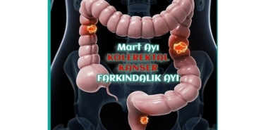 Kolorektal (Kalın Bağırsak) Kanseri Farkındalık Ayı